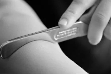 Physical therapist uses ergonomic tool to perform Graston Technique on the arm of a patient.